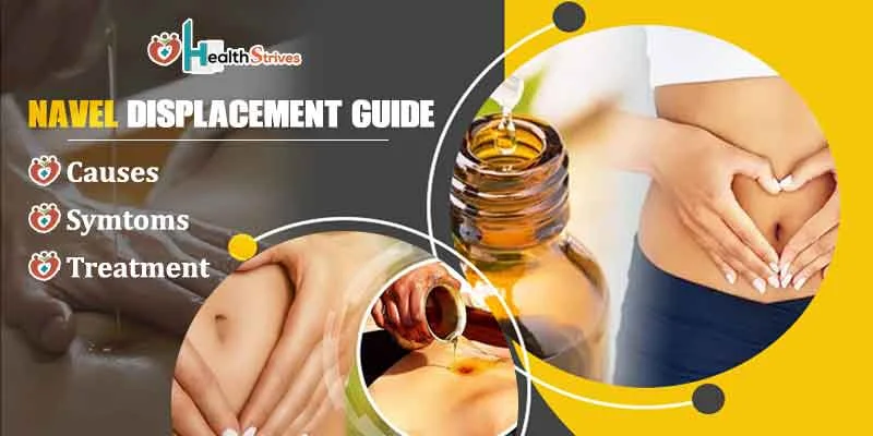 Navel Displacement: Causes, Symptoms, and Treatmen